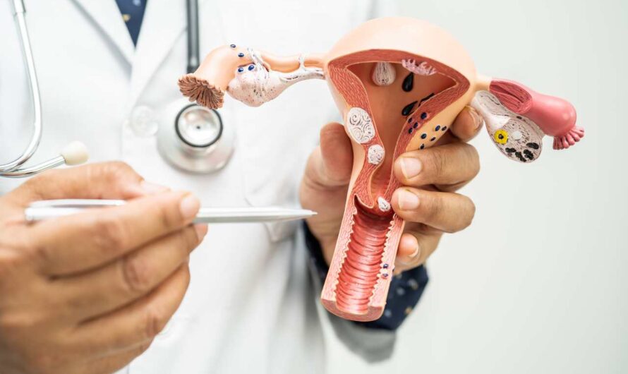 Czym są mięśniaki macicy i czy mają wpływ na płodność?