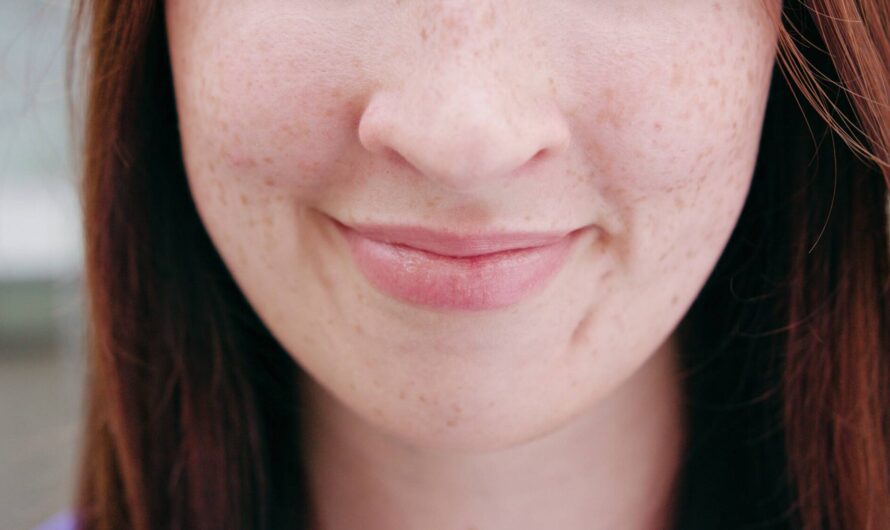 Jak walczyć z czerwonymi plamami i przebarwieniami na twarzy? Sprawdzone metody i polecane kosmetyki